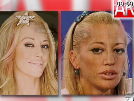 comparacion caras belen esteban